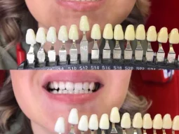Студия отбеливания зубов White&Smile фотография 2